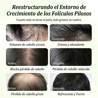 BATANA SHAMPOO
